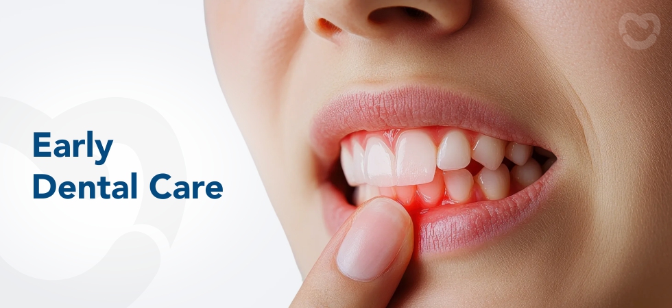 Early Signs of Dental Problems