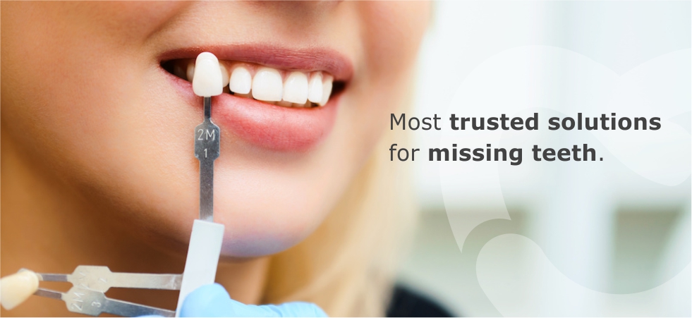 How Safe Are Dental Implants? A Complete Guide
