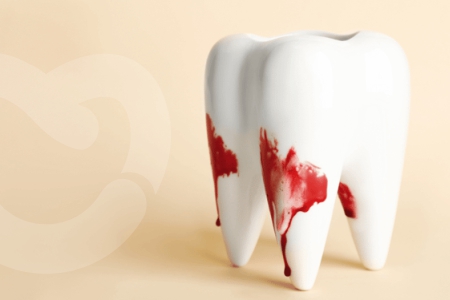 Dental Health Alert: Early Warning Signs You Need a Dentist