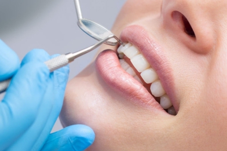 How Often Should You Go to the Dentist? A Simple Guide