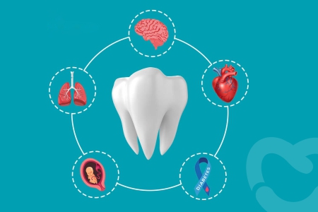 How Poor Oral Health Affects Overall Health