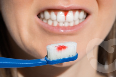 Is Your Toothbrush Damaging Your Teeth