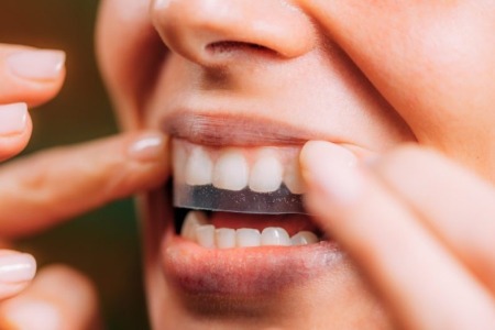 Teeth Whitening Strips vs Professional Whitening Treatments: Which Is More Effective