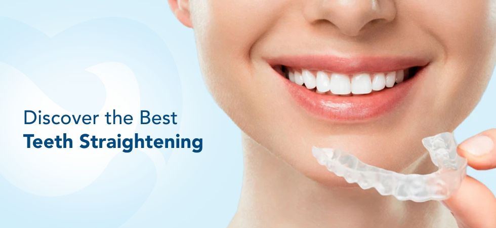 Best Teeth Straightening Methods for Every Budget