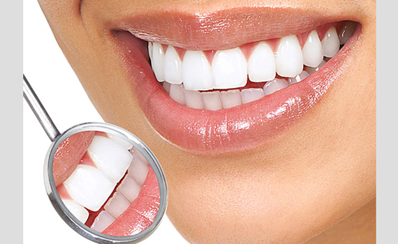 Dental Crowns in Belgaum